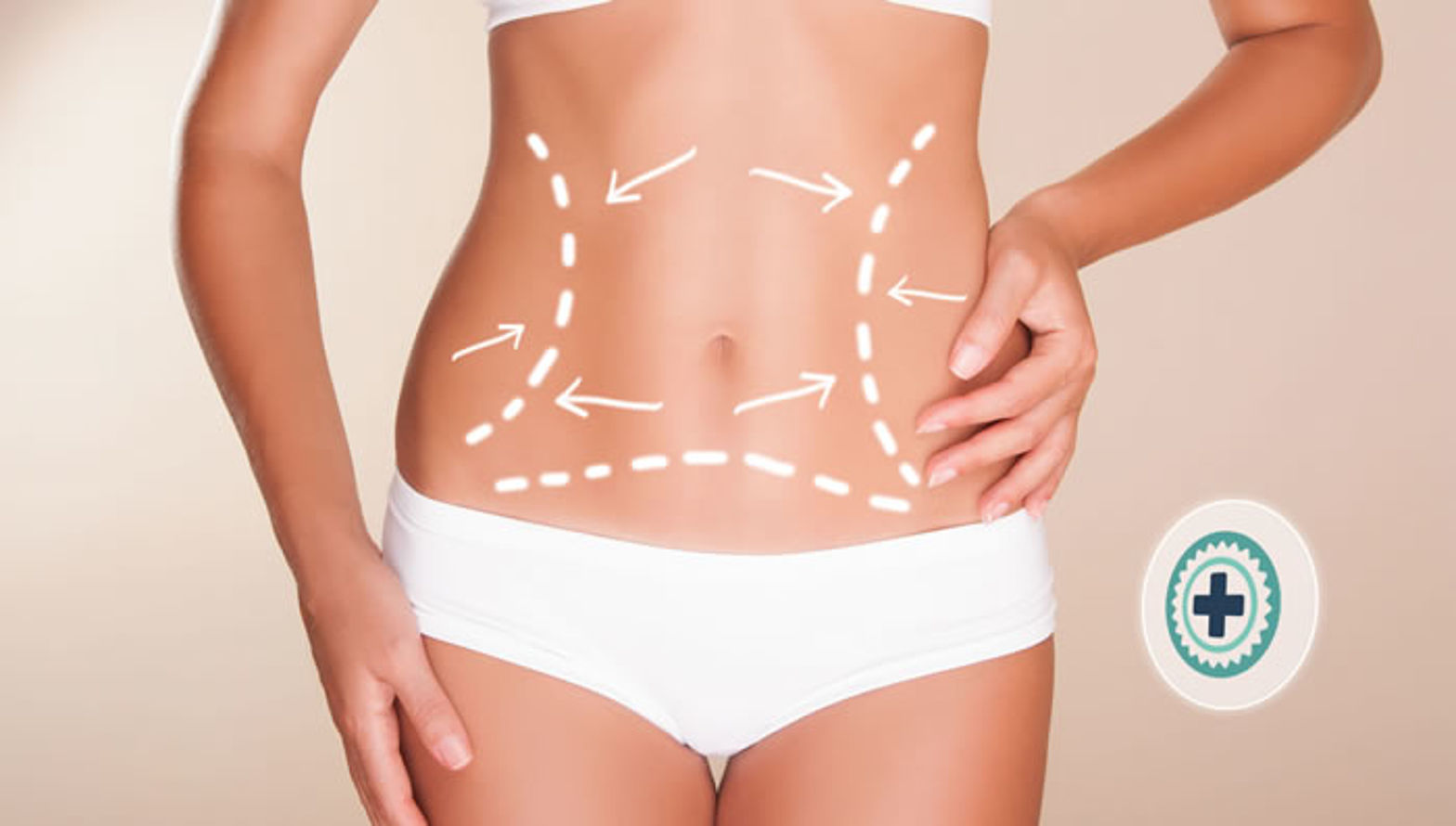 Bauchdeckenstraffung in NRW: Ihr vertrauenswürdiger Partner für plastische Chirurgie